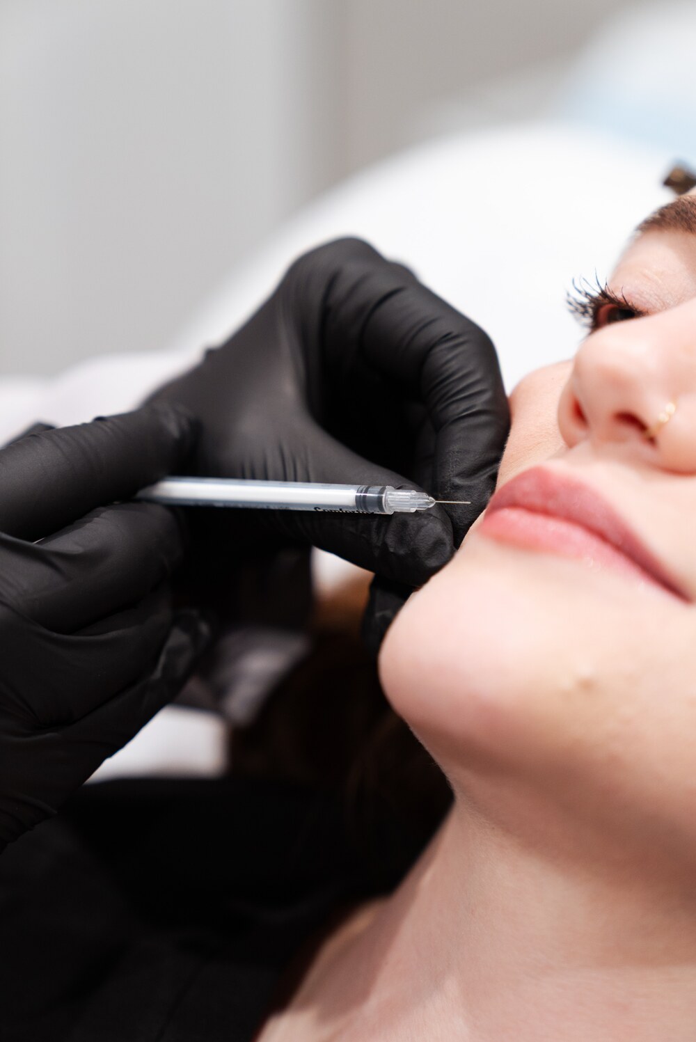 Kybella jawline contouring treatment by REVIVE clinician in Roseburg