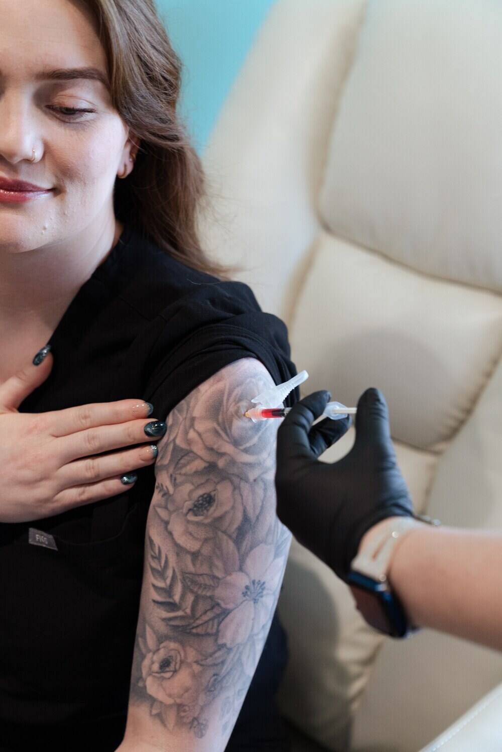 Microneedling regenerative treatment on arm tattoo area