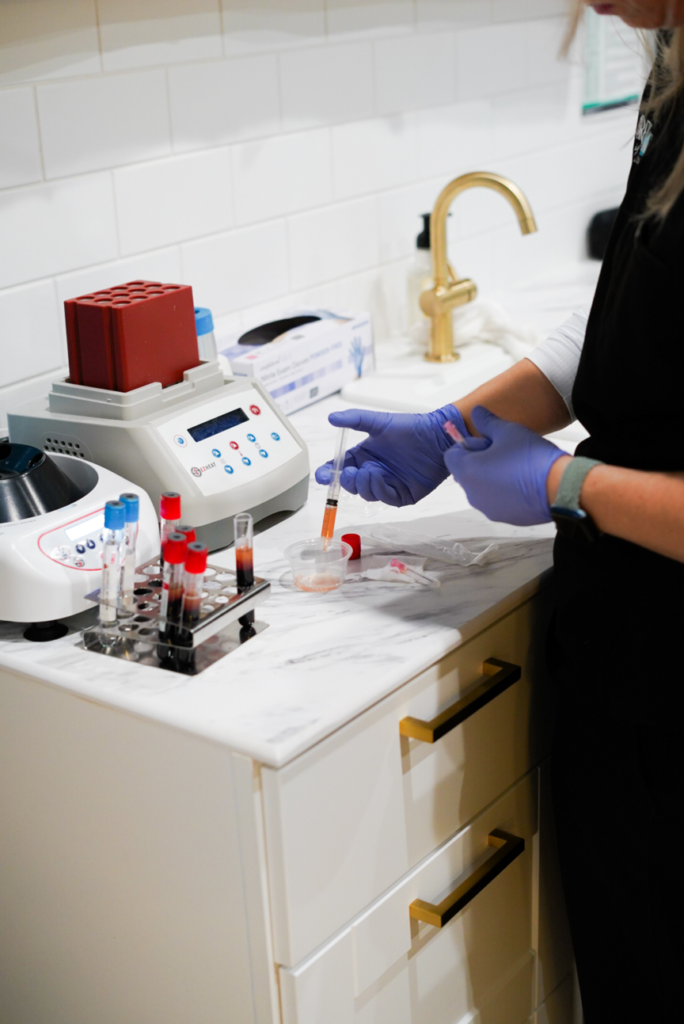 image of a medical professional activating PRF EZ Gel with the patients own blood plasma that was put through a centrifuge.