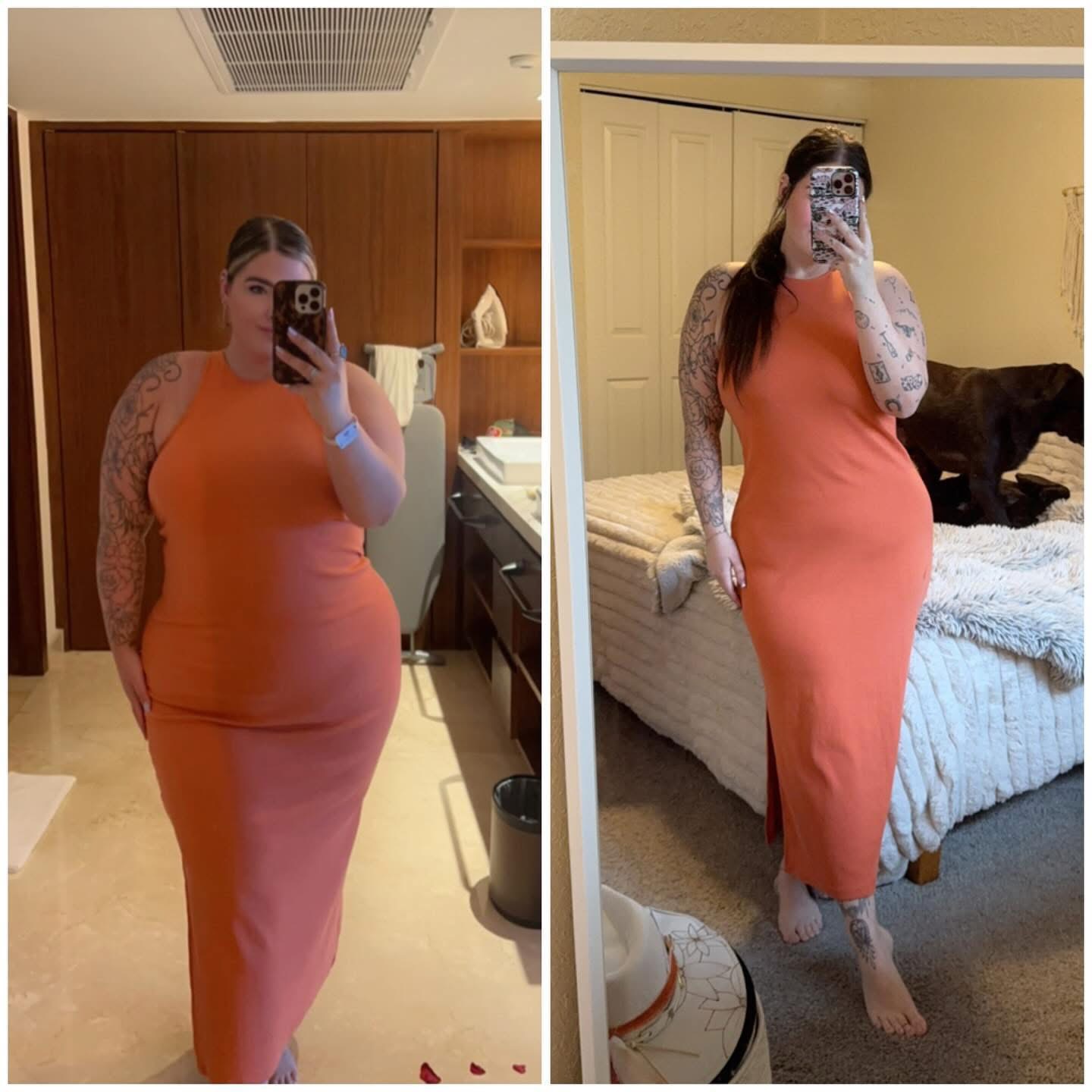 Before-and-after photo of a patient’s extreme health and wellness transformation from a 6-month medically supervised weight loss program at Revive Infusions & Wellness in Roseburg, Oregon and utilizing their Medical Weight Loss Clinic, emphasizing personalized, measurable results.