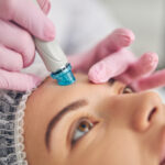 Doctor performing a facial skin cleansing procedure Close-up portrait of a female patient undergoing microneedling forehead treatment for anti-aging at Revive Infusions & Wellness, a luxury medical spa in Roseburg, Oregon currently accepting new patients.