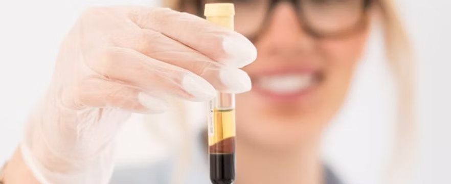 PRP Hair Loss Treatment -youthful-glowing-skin-mesotherapy Medical Provider Chenelle McCaskill is smiling and wearing gloves with a manicure holding up a vial of patient blood with that has gone through the centrifuge and has been spun into its various components. These components will be use for Mesotherapy and skin boosters used for anti-aging.