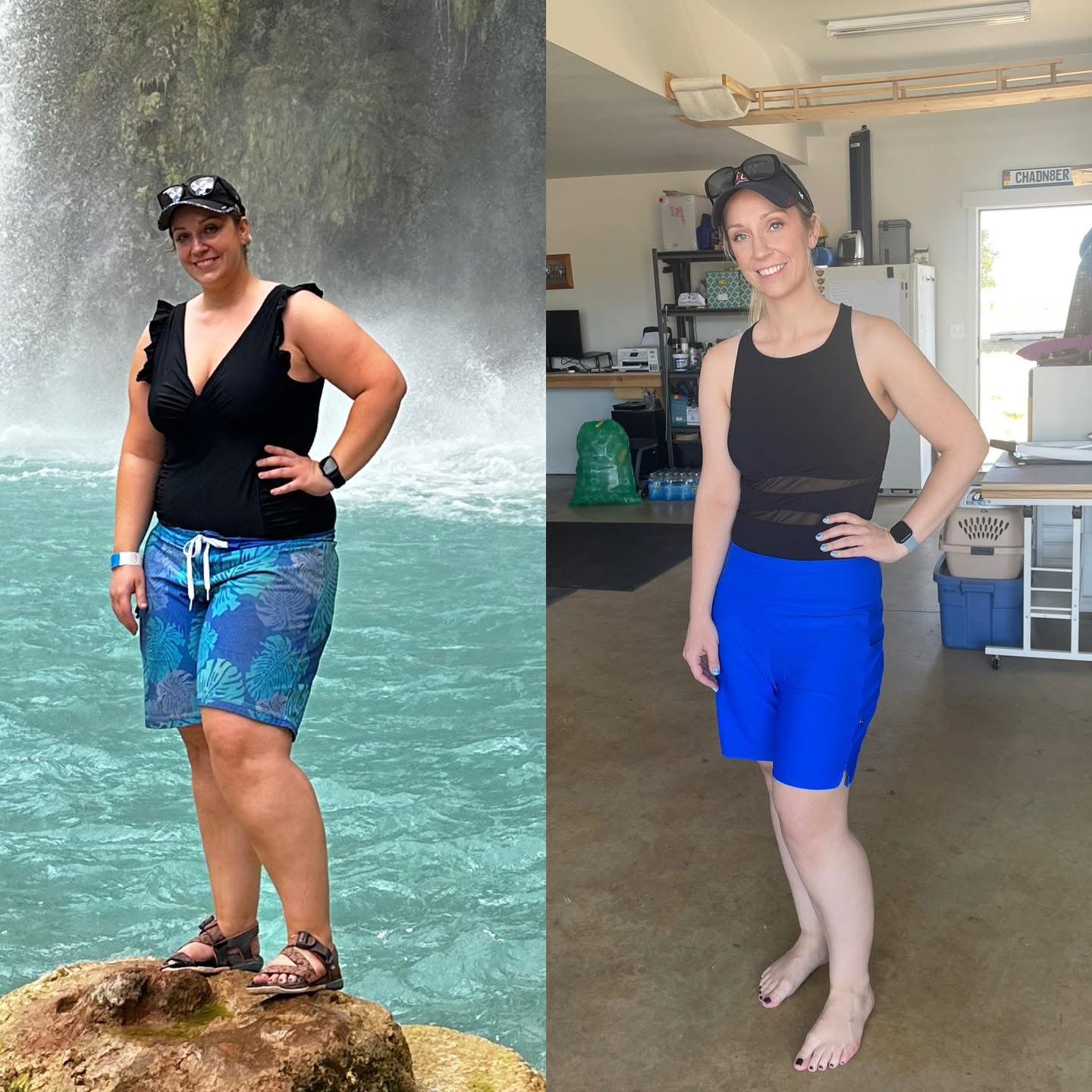 REVIVE medical weight loss before and after transformation