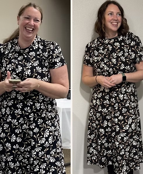 REVIVE medical weight loss before and after transformation